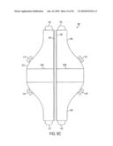 GASTRIC RESTRICTION DEVICES WITH FILLABLE CHAMBERS AND ABLATION MEANS FOR TREATING OBESITY diagram and image