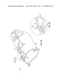 GASTRIC RESTRICTION DEVICES WITH FILLABLE CHAMBERS AND ABLATION MEANS FOR TREATING OBESITY diagram and image