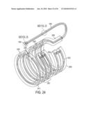 GASTRIC RESTRICTION DEVICES WITH FILLABLE CHAMBERS AND ABLATION MEANS FOR TREATING OBESITY diagram and image