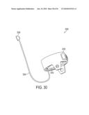 GASTRIC RESTRICTION DEVICES WITH FILLABLE CHAMBERS AND ABLATION MEANS FOR TREATING OBESITY diagram and image