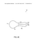 GASTRIC RESTRICTION DEVICES WITH FILLABLE CHAMBERS AND ABLATION MEANS FOR TREATING OBESITY diagram and image