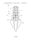 Introducer Tool for Bone Measurement diagram and image