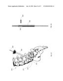 Introducer Tool for Bone Measurement diagram and image