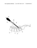 Introducer Tool for Bone Measurement diagram and image