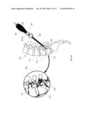 Introducer Tool for Bone Measurement diagram and image