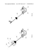 Introducer Tool for Bone Measurement diagram and image