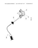 Introducer Tool for Bone Measurement diagram and image