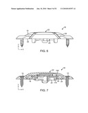 BURR HOLE PLUG HAVING DUAL SLIDABLE CLAMPING MECHANISMS diagram and image