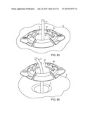 BURR HOLE PLUG HAVING DUAL SLIDABLE CLAMPING MECHANISMS diagram and image