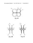 TUBULAR PATENT FORAMEN OVALE (PFO) CLOSURE DEVICE WITH CATCH SYSTEM diagram and image