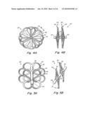 TUBULAR PATENT FORAMEN OVALE (PFO) CLOSURE DEVICE WITH CATCH SYSTEM diagram and image