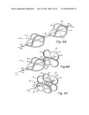 TUBULAR PATENT FORAMEN OVALE (PFO) CLOSURE DEVICE WITH CATCH SYSTEM diagram and image