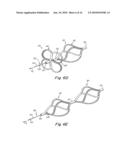 TUBULAR PATENT FORAMEN OVALE (PFO) CLOSURE DEVICE WITH CATCH SYSTEM diagram and image