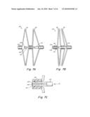 TUBULAR PATENT FORAMEN OVALE (PFO) CLOSURE DEVICE WITH CATCH SYSTEM diagram and image