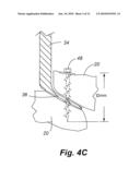 APPARATUS AND METHOD OF SPINAL IMPLANT AND FUSION diagram and image