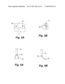 APPARATUS AND METHOD OF SPINAL IMPLANT AND FUSION diagram and image