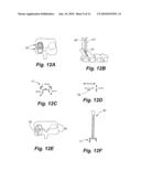 APPARATUS AND METHOD OF SPINAL IMPLANT AND FUSION diagram and image