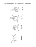 APPARATUS AND METHOD OF SPINAL IMPLANT AND FUSION diagram and image