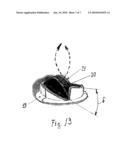 IMPLANTABLE PROSTHETIC VALVE STENT diagram and image