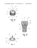 PROSTHETIC VALVLE FOR INTRALUMINAL IMPLANTATION diagram and image