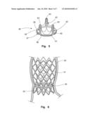 PROSTHETIC VALVLE FOR INTRALUMINAL IMPLANTATION diagram and image