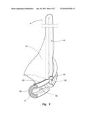 PROSTHETIC VALVLE FOR INTRALUMINAL IMPLANTATION diagram and image