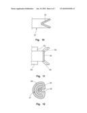 PROSTHETIC VALVLE FOR INTRALUMINAL IMPLANTATION diagram and image