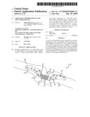 ADJUSTABLE ABSORBER DESIGNS FOR IMPLANTABLE DEVICE diagram and image