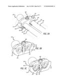 ADJUSTABLE ABSORBER DESIGNS FOR IMPLANTABLE DEVICE diagram and image