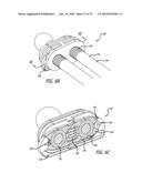 ADJUSTABLE ABSORBER DESIGNS FOR IMPLANTABLE DEVICE diagram and image