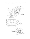 ADJUSTABLE ABSORBER DESIGNS FOR IMPLANTABLE DEVICE diagram and image