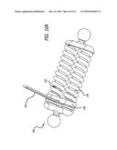 ADJUSTABLE ABSORBER DESIGNS FOR IMPLANTABLE DEVICE diagram and image