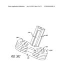 ADJUSTABLE ABSORBER DESIGNS FOR IMPLANTABLE DEVICE diagram and image