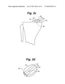 METHOD AND SYSTEM FOR MAMMALIAN JOINT RESURFACING diagram and image