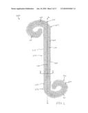 Porous Ureteral Stent diagram and image