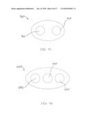 Porous Ureteral Stent diagram and image