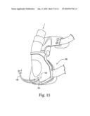 Ventless Mask CPAP System diagram and image