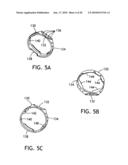 Respiratory Access Port Assembly With Push Button Lock and Method of Use diagram and image