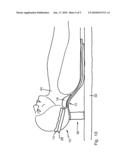 SUPPORT FOR SUPPORTING A PATIENT diagram and image