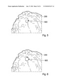 METHOD AND SYSTEM FOR DENTAL PLANNING diagram and image