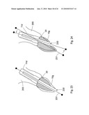 METHOD AND SYSTEM FOR DENTAL PLANNING diagram and image