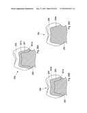 METHOD AND SYSTEM FOR DENTAL PLANNING diagram and image