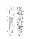 DENTAL IMPLANT diagram and image