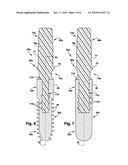 DENTAL IMPLANT diagram and image