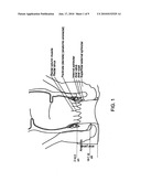 FECAL INCONTINENCE DEVICE, SYSTEM AND METHOD diagram and image