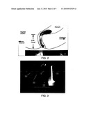 FECAL INCONTINENCE DEVICE, SYSTEM AND METHOD diagram and image