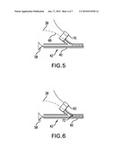 DEVICE FOR PREVENTING ENDOSCOPE DAMAGE BY ERRANT LASER FIRE IN A SURGICAL LASER diagram and image