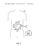 POSITIONABLE IMAGING MEDICAL DEVICES diagram and image