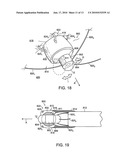 POSITIONABLE IMAGING MEDICAL DEVICES diagram and image