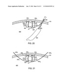 POSITIONABLE IMAGING MEDICAL DEVICES diagram and image